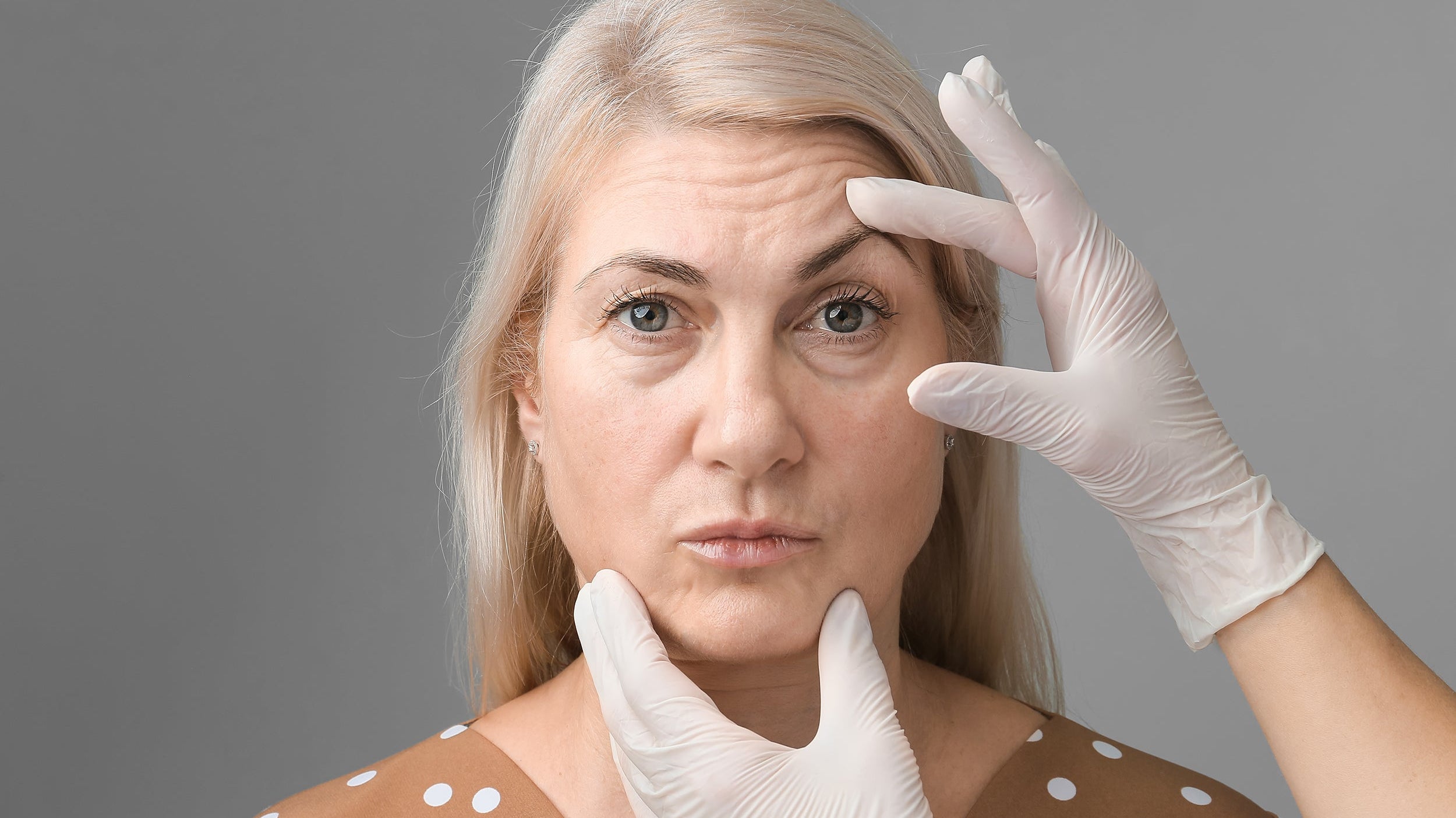 A woman considering a brow lift. Sleep positioning after a brow lift directly influences swelling, healing speed, and results.