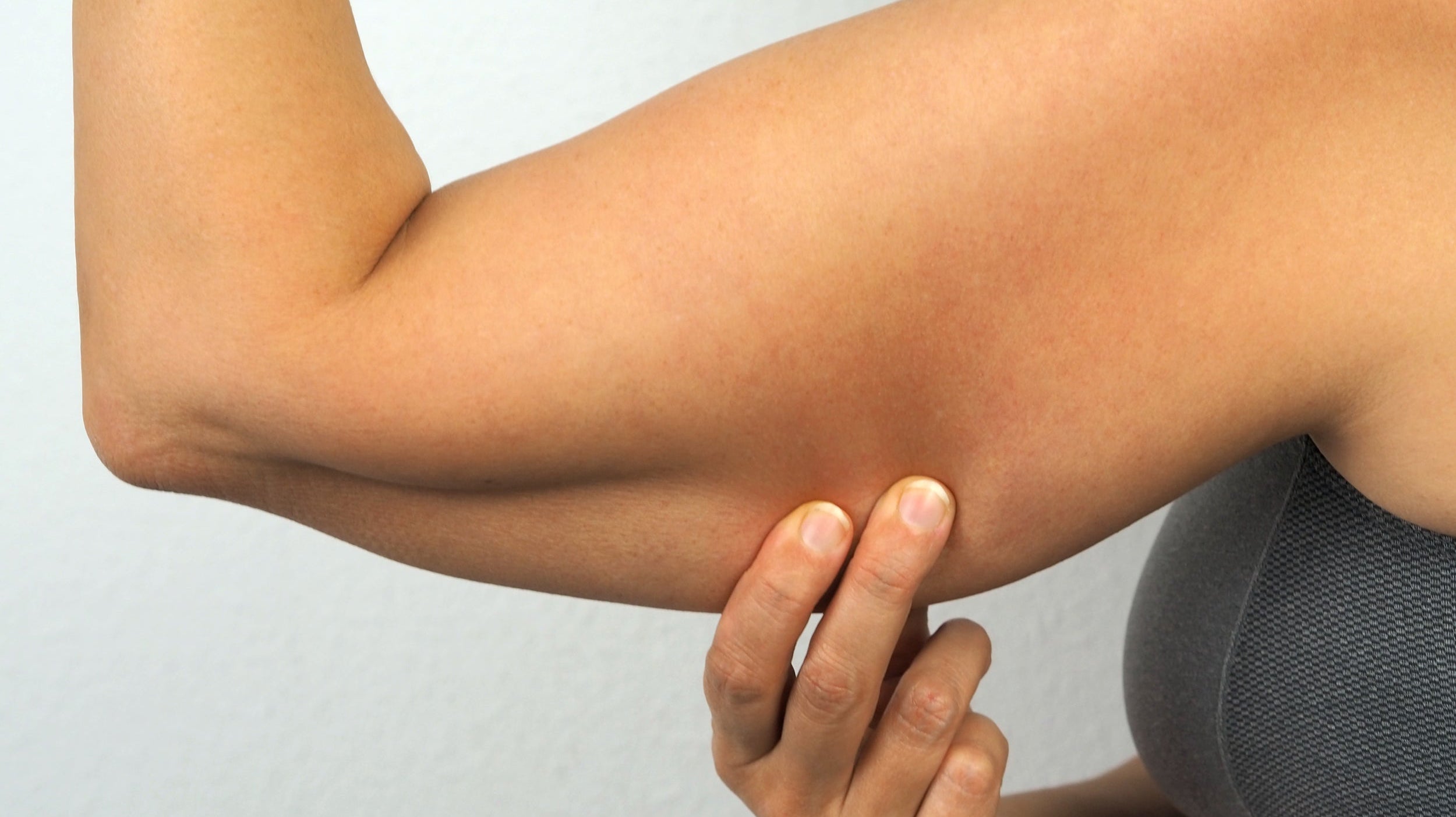 How to Sleep After an Arm Lift: Your Complete Pre-Surgery Sleep Planning Guide