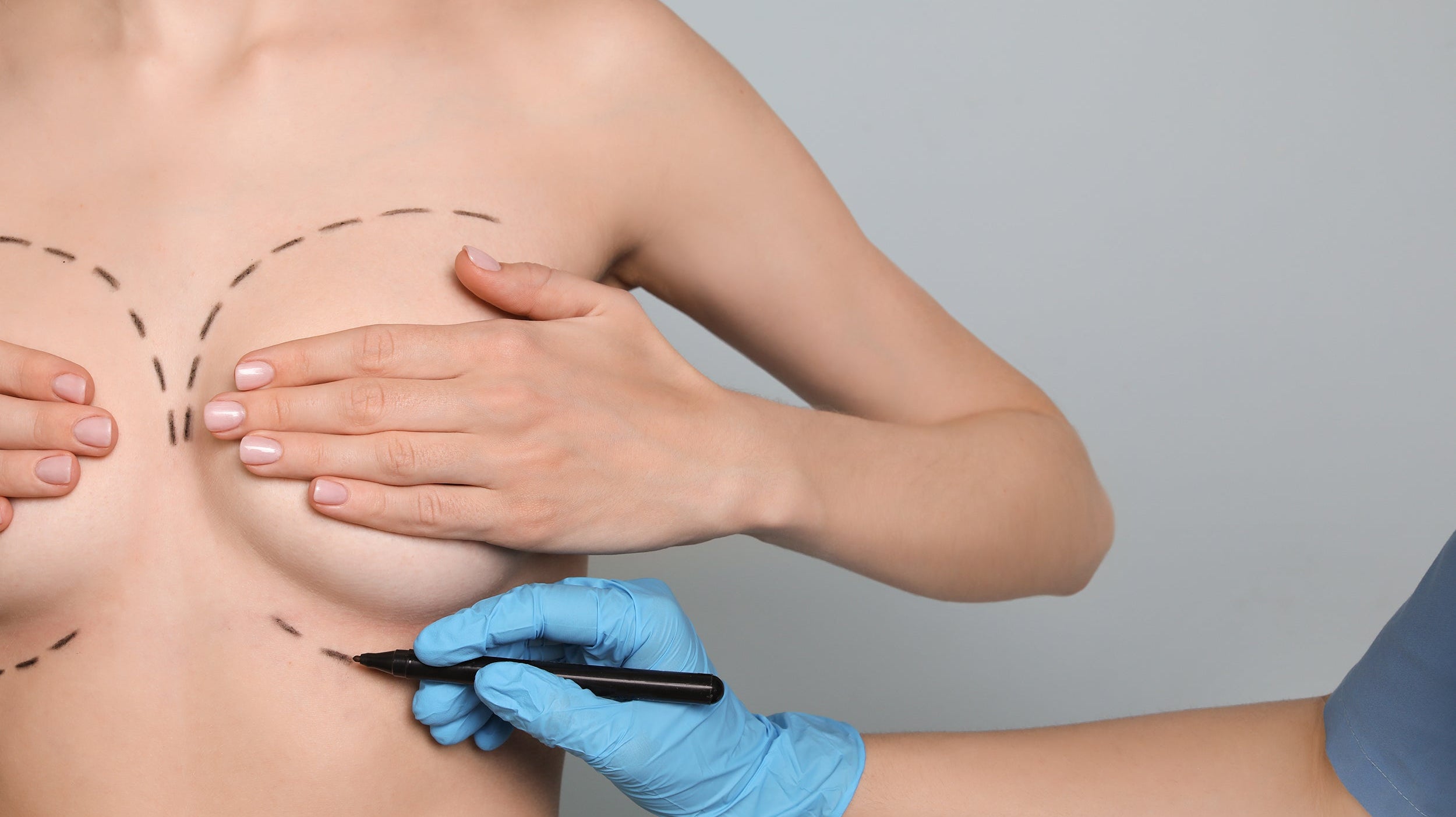 Sleeping after a breast lift starts before surgery. Learn the elevated back sleeping position surgeons recommend — and how to prep your setup in advance.