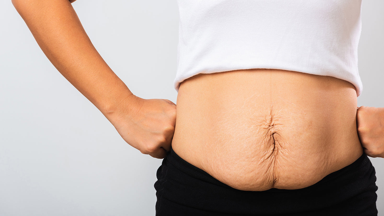 A woman with excess skin. Elevated back sleeping at 30–45° is the surgical standard after skin removal surgery. Here's how to maintain it all night and why it shapes your results.