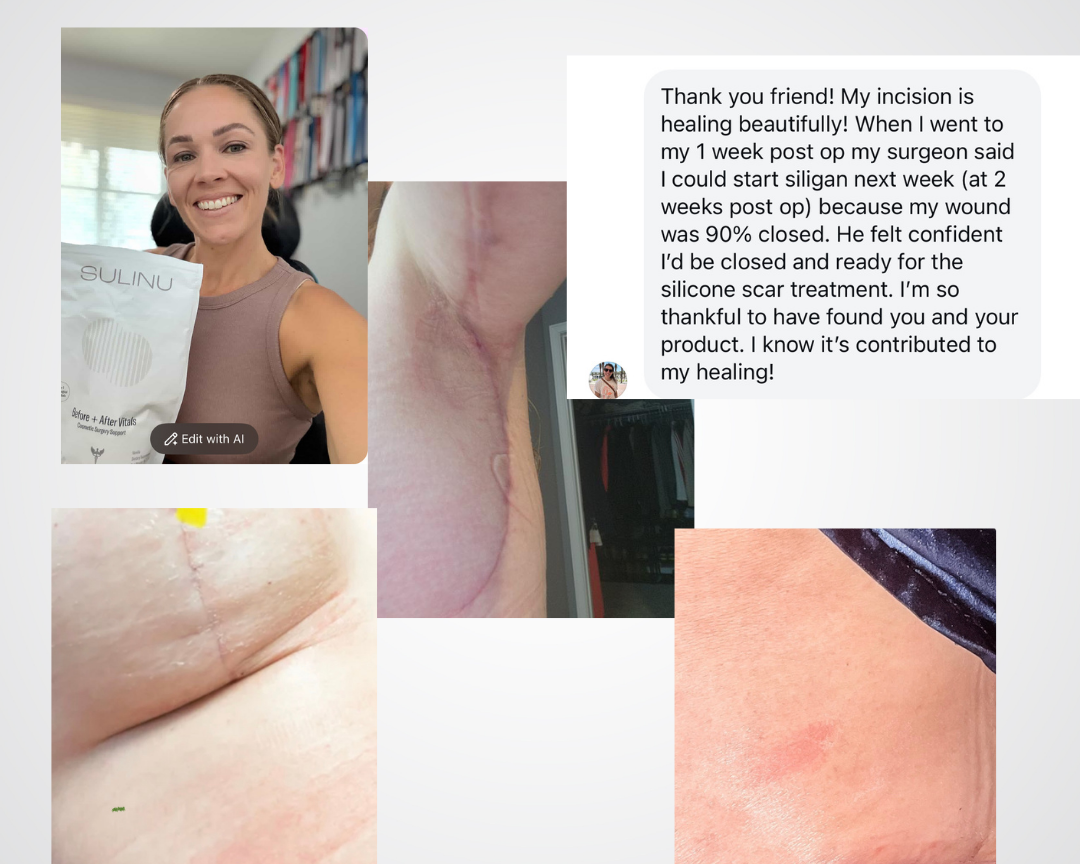 A collage shows a smiling woman with Before + After Vitals - NutriSurgical Vitamin Powder, close-ups of healed scars, and reviews praising its effectiveness for incision healing and as a top pre/post-surgery supplement for fast recovery.
