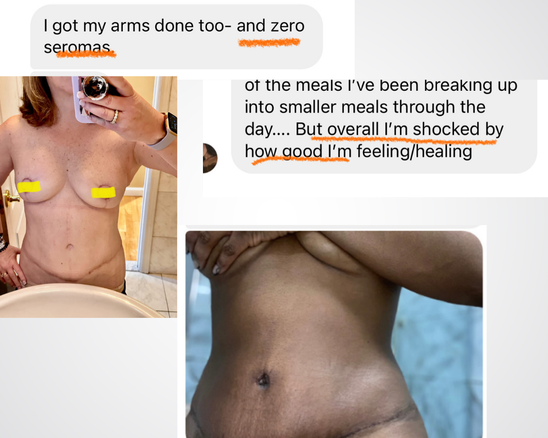 A collage shows a woman’s healed torso with minimal scarring after surgery—thanks to Before + After Vitals NutriSurgical Vitamin Powder—text messages praising her healing and no seromas, with “Trusted by Surgeons. Loved by You.” at the top.