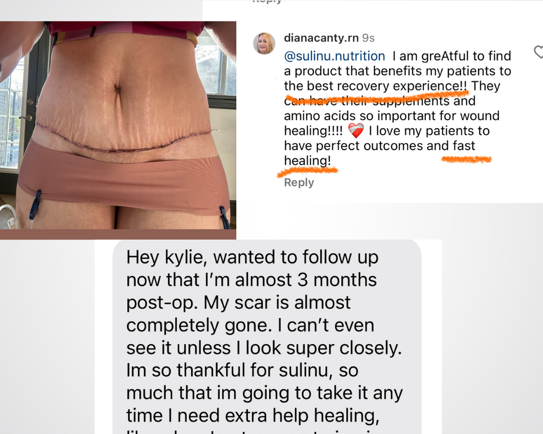 A social media post shows a woman’s healed abdominal scar. Overlay text features a surgeon praising Before + After Vitals - NutriSurgical Vitamin Powder for wound healing and a patient thanking it for improved incision recovery.
