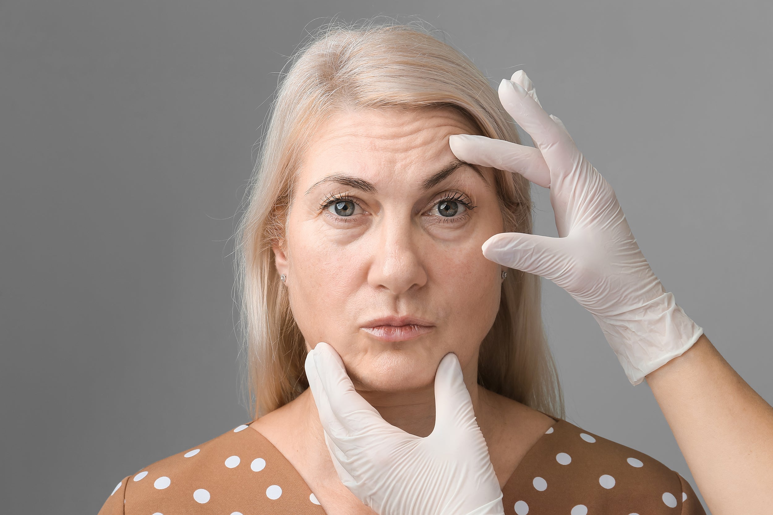 A woman considering a brow lift. Sleep positioning after a brow lift directly influences swelling, healing speed, and results. 