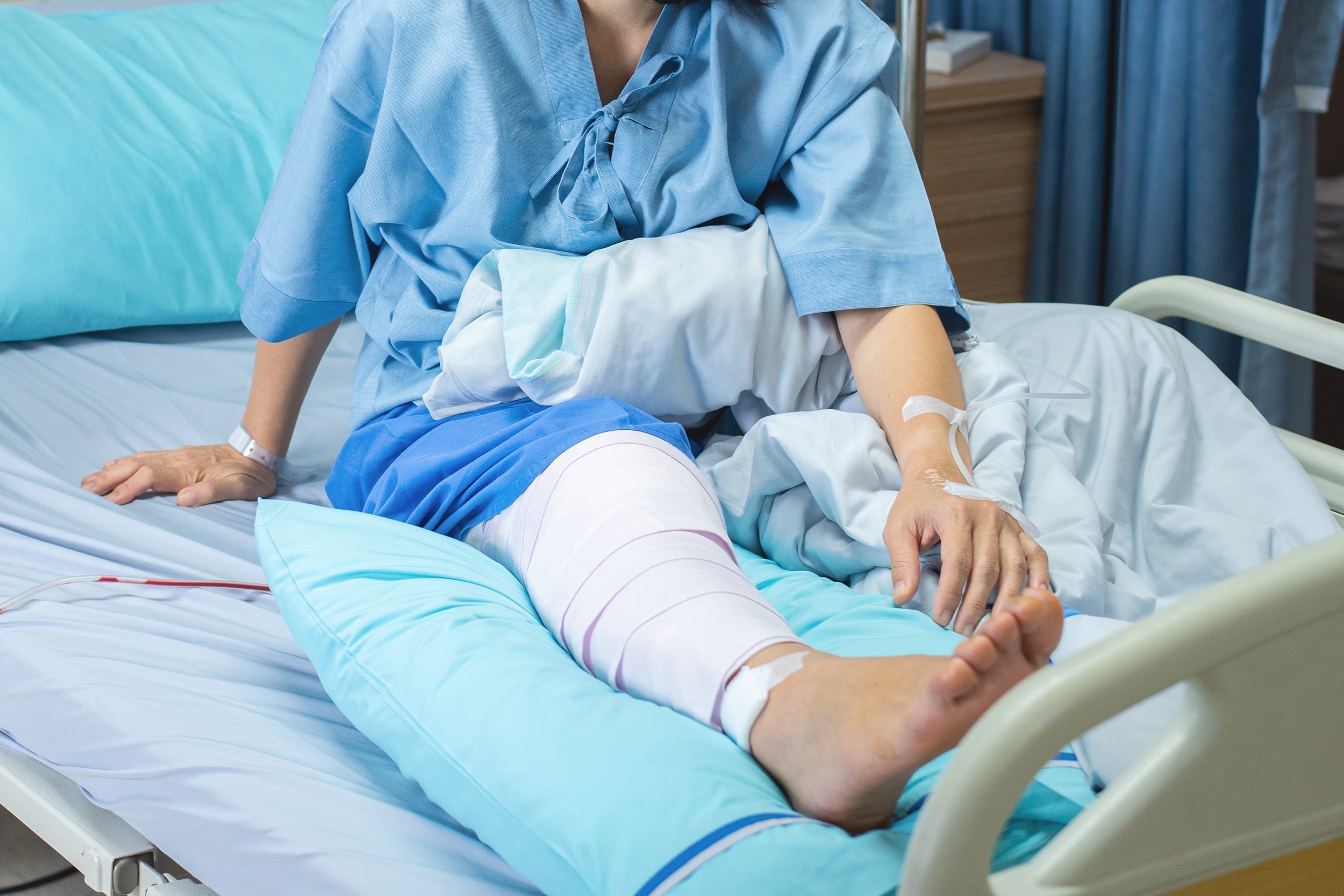 A woman recovers in a hospital bed after ACL surgery. Sleeping after ACL surgery can be challenging. To boost healing and recovery, explore our guide on how to sleep after ACL surgery.